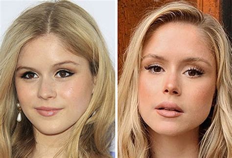 erin moriarty breast implants|Erin Moriarty Plastic Surgery Before and After